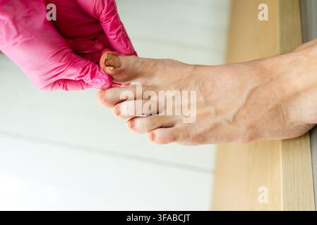 Primo piano di un podologo che tiene ed esamina un piede e le dita con pianta, tallone e pelle visibili. Uno specialista calmo cura il piede del paziente controllando l'unghia dell'alluce e delle dita in una clinica podologica sterile. Foto Stock