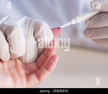 Il medico preleva campioni di sangue dal dito Foto Stock