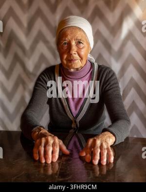 Anziana signora. Mani di una donna anziana con malattia reumatoide. Foto Stock