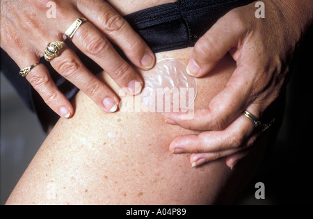 Donna in menopausa mettendo su una patch di HRT. Foto Stock