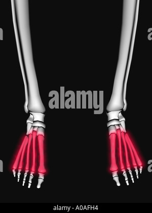 Schema illustrativo che mostra lo scheletro di piedi con metatarsals evidenziata in un bagliore rosso Foto Stock