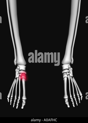 Schema illustrativo che mostra lo scheletro mostra tarsale evidenziata in un bagliore rosso Foto Stock