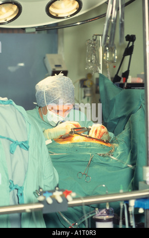 Signora chirurgo azionando Quadruple bypass cardiaco Foto Stock