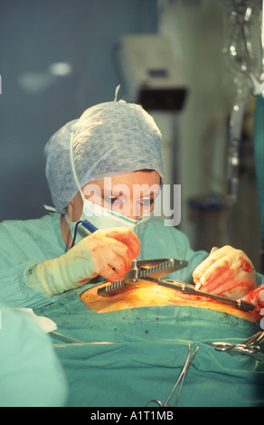 Signora chirurgo azionando Quadruple bypass cardiaco Foto Stock