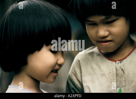 Le sorelle Lien, 8 anni, e Hien, 6 anni, sono nate dopo che il loro padre è stato spruzzato durante la guerra del Vietnam con l'agente Orange dagli aerei degli Stati Uniti. Né hanno lenti nei loro occhi. Foto Stock