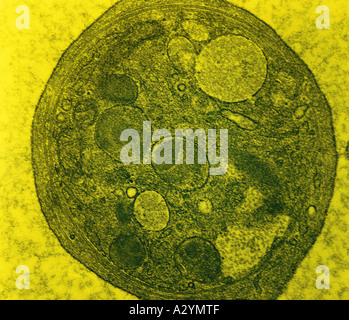 Piastrine nel sangue Foto Stock