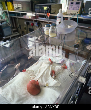 Bambino prematuro in incubatore Foto Stock