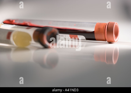 Primo piano dei campioni di sangue in provette Foto Stock