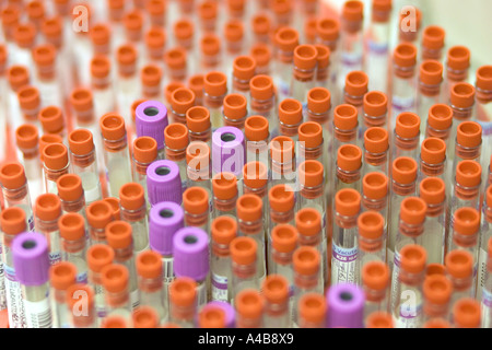 Automated Test del sangue di apparecchiature a St Marys Hospital di Londra Foto Stock