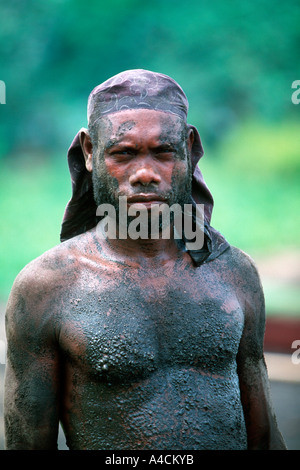 Coperti di polvere vulcanica di cenere e sporco di un nativo Matupit Islander prende una pausa da scavo uova Megapodes Foto Stock