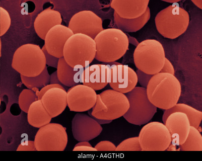 Questo è un colore enhanced scanning electron microfotografia di Staphylococcus aureus. Foto Stock