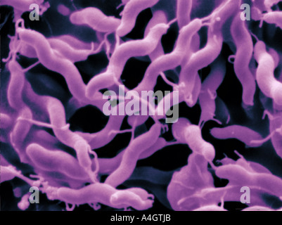 Questo è un colore enhanced scanning electron microfotografia del batterio Campylobacter jejuni Foto Stock