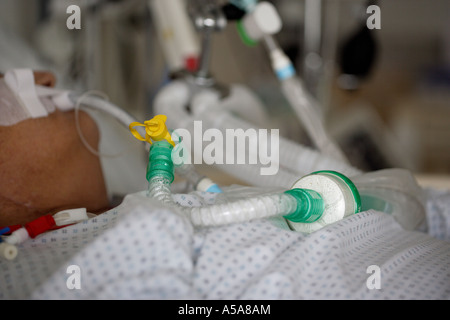 Un paziente in unità di terapia intensiva Foto Stock