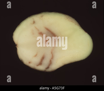 Sintomi interni di spraing in tubero di patata causato da Potato Mop Top Virus PMTV Foto Stock