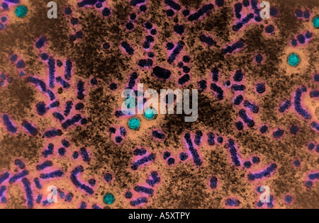 Microscopio elettronico a trasmissione negativa immagine macchiata del filtro HEPA Foto Stock