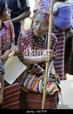 GUATEMALA ACAL un anziano maya Mam donna in evidente dolore agli occhi offuscato con cataratta Foto Stock