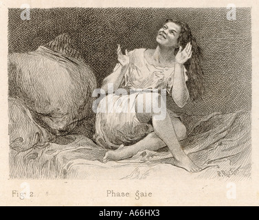 1881 isterico paziente Foto Stock