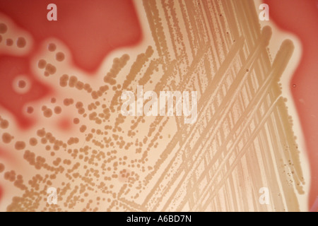 Lo Staphylococcus Aureus in capsule di Petri Foto Stock
