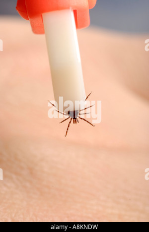 Tick (Ixodida) essendo rimosso con pinza tick Foto Stock