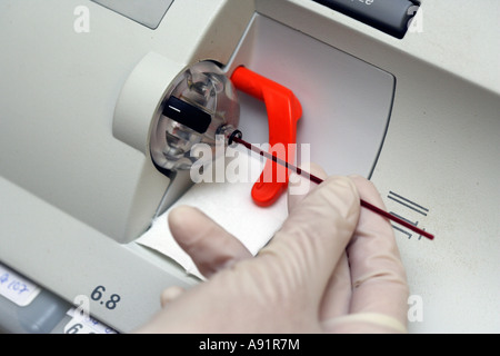 Emogasanalisi strumento è dotato di sangue di prova Foto Stock