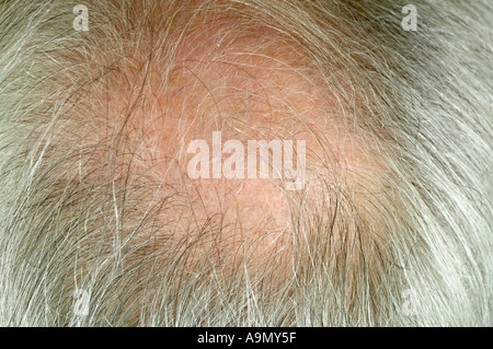 Uomo anziano verticale fino in prossimità della parte posteriore della testa per radere Foto Stock