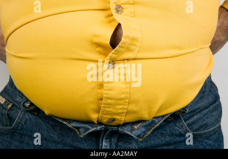 Amico, lo stomaco dell'uomo obeso con la pancia di birra grassa che scoppia Foto Stock