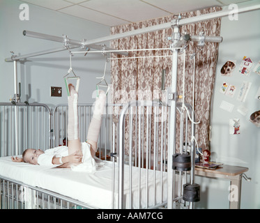 Anni sessanta bambino nel letto di ospedale trazione con due gambe rotte guardando la fotocamera Foto Stock