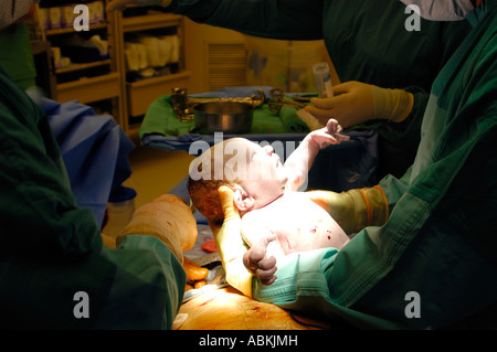 Il parto del bambino mediante taglio cesareo San Diego California USA Foto Stock