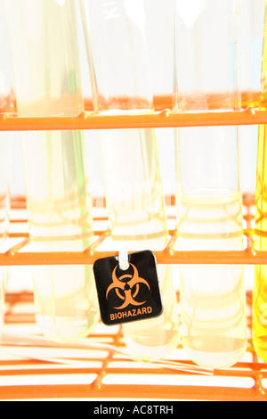 Etichetta di rischio biologico su esami di laboratorio le provette per la prova Foto Stock