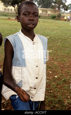 Sniffer di colla con gravi disabilità nel parco, Kampala, Uganda Foto Stock