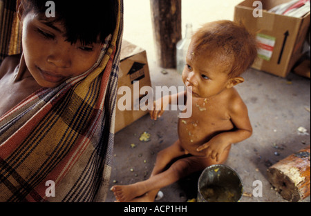 Malati Yanomami famiglia presso gli Indiani Casa Ospedale per i popoli indigeni a Boa Vista Città Stato Roraima Amazzonia Brasile Foto Stock