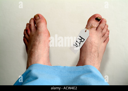 I piedi di un Dead Mans del corpo in una camera mortuaria dopo un fatale incidente d'auto. Foto Stock