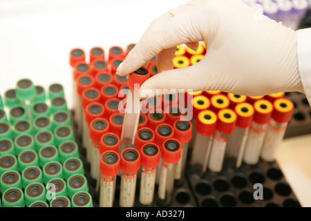 Esame del sangue le provette per campioni Foto Stock