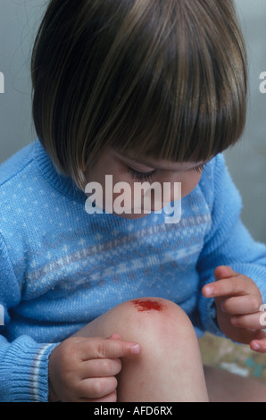 Bambino con un pascolano sul suo ginocchio Foto Stock