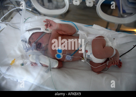 Il bambino addormentato in un incubatore Foto Stock