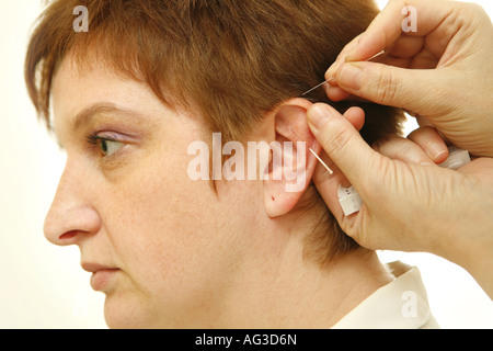 Doctor applys accupuncture aghi per orecchio Foto Stock