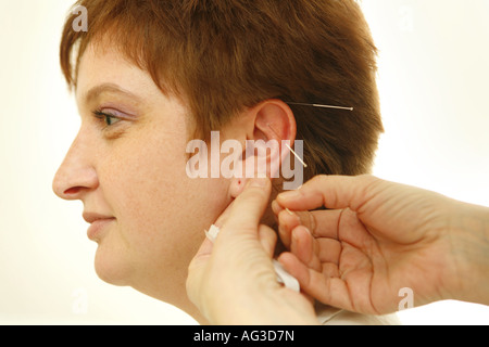 Doctor applys accupuncture aghi per orecchio Foto Stock