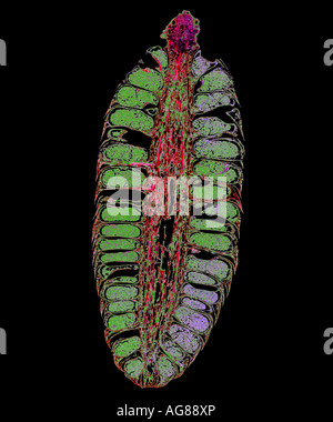 Maschio cono di Pino (Pinus) sezione a cono Foto Stock