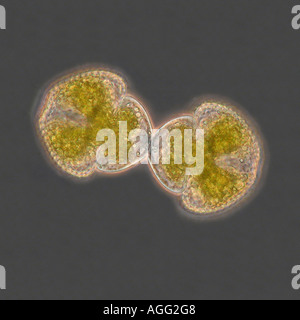 Hyalotheka dissilens Cosmarium (spec.), con contrasto di fase MRI, la divisione cellulare, citochinesi Foto Stock