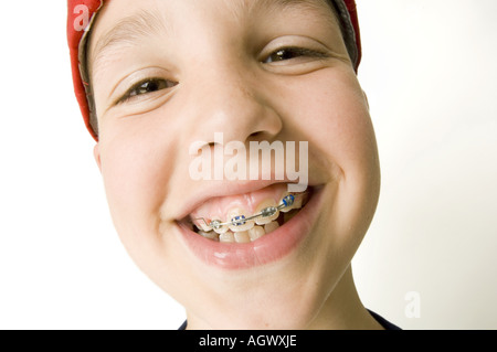 Ragazzo caucasico con un grande sorriso indossando le bretelle sui denti Foto Stock