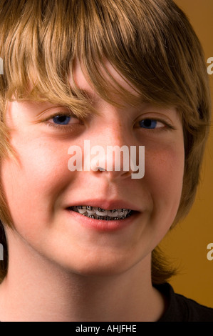 Ragazzo con rinforzi su i suoi denti Foto Stock