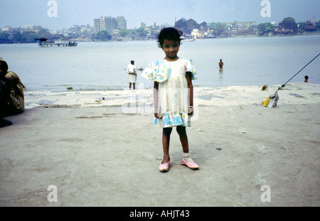 Calcutta India Nimtola Ghat bambino con il rachitismo Foto Stock