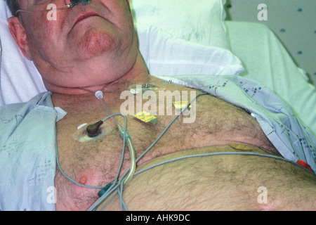 Riposo in ICU dopo chirurgia cardiaca Foto Stock