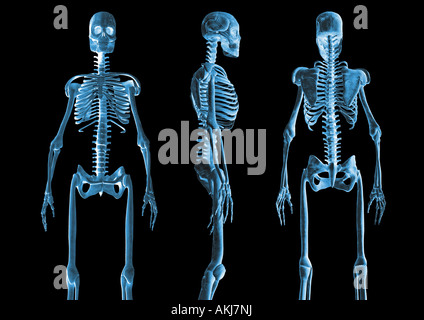 Scheletri di scheletro diverse viste Skelette verschiedene Ansichten Foto Stock