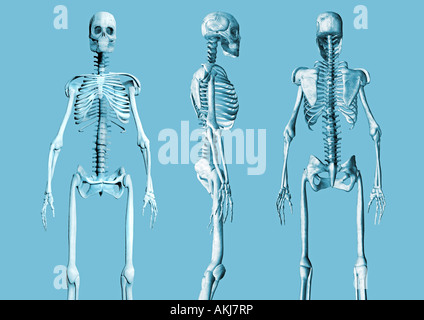 Scheletri di scheletro diverse viste Skelette verschiedene Ansichten Foto Stock