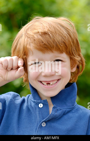 Ragazzo con un dente spazio vuoto a perdere il suo bambino denti decidui denti di latte Foto Stock