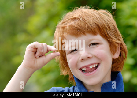 Ragazzo con un dente spazio vuoto a perdere il suo bambino denti decidui denti di latte Foto Stock