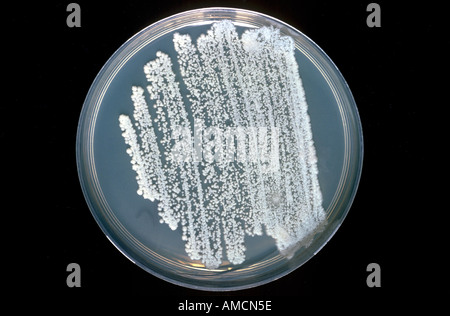 Candida albicans da sputo Foto Stock