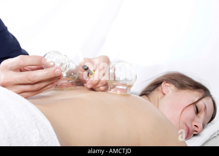 Giovane donna giaceva sul letto ricevente di agopuntura coppettazione Foto Stock