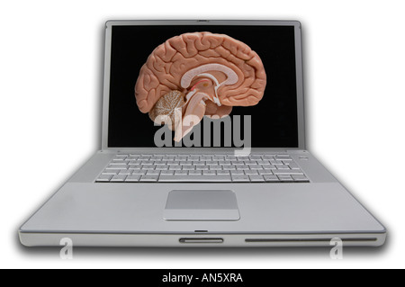 LAP TOP computer portatile con schermo di visualizzazione immagine di fetta attraverso il cervello umano Foto Stock